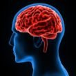 cerebro1