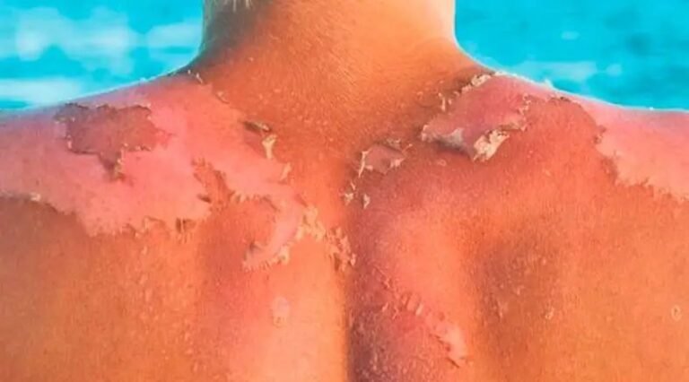 WhatsApp Image 2026 04 01 at 3.27.18 PM