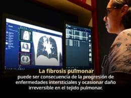 WEB Y BLOG